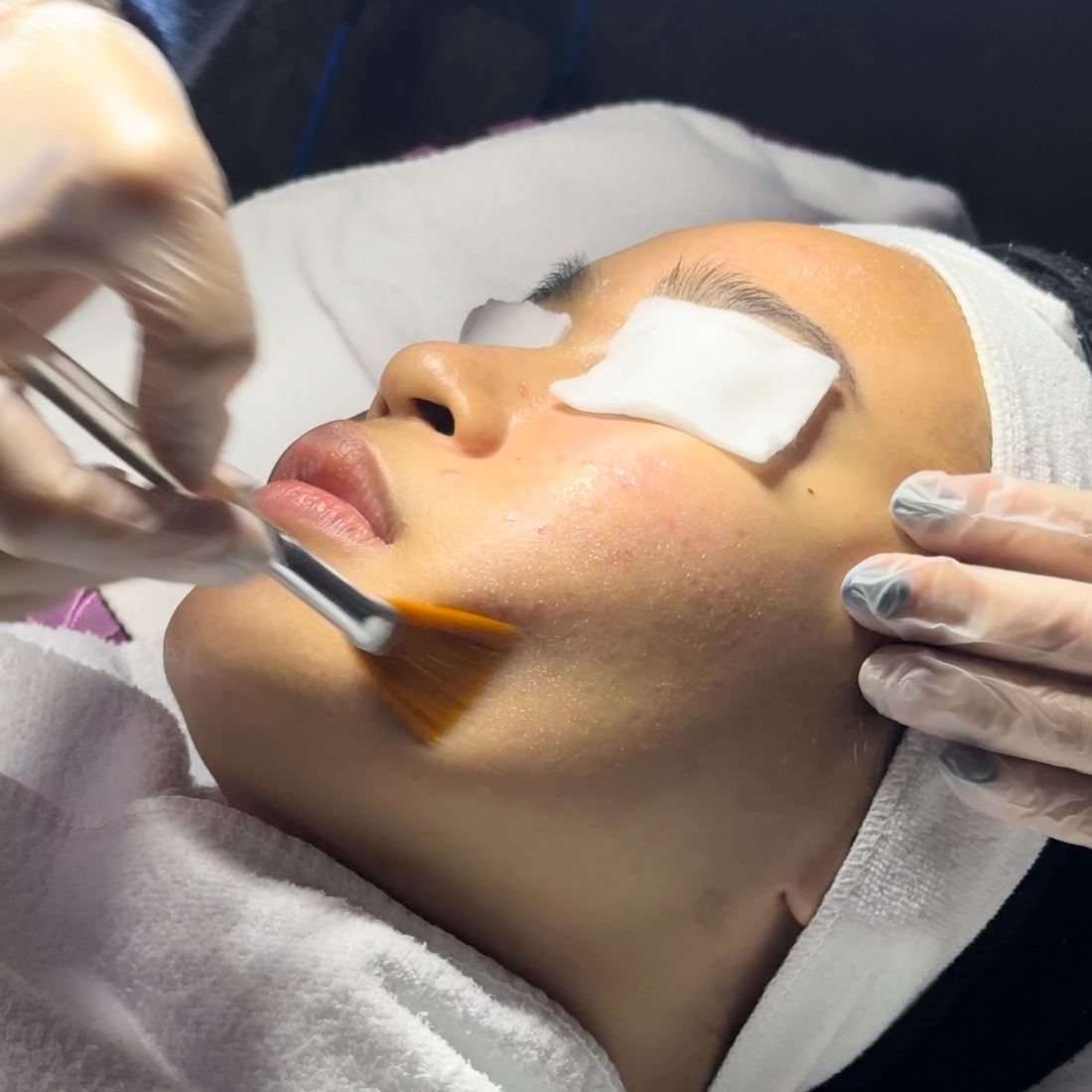 Clarifying Booster Peel