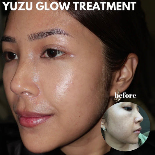 Yuzu Perfect Brightening Treatment